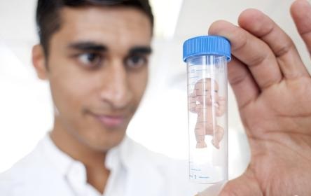 如何防止做試管嬰兒后發生腹水？