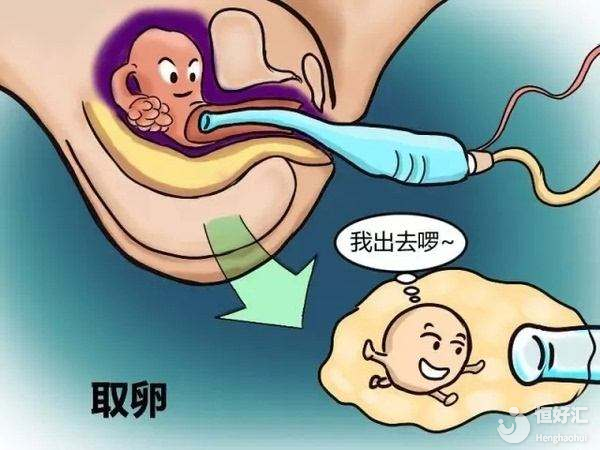 試管嬰兒取卵后的注意事項(xiàng)，助你快速恢復(fù)！